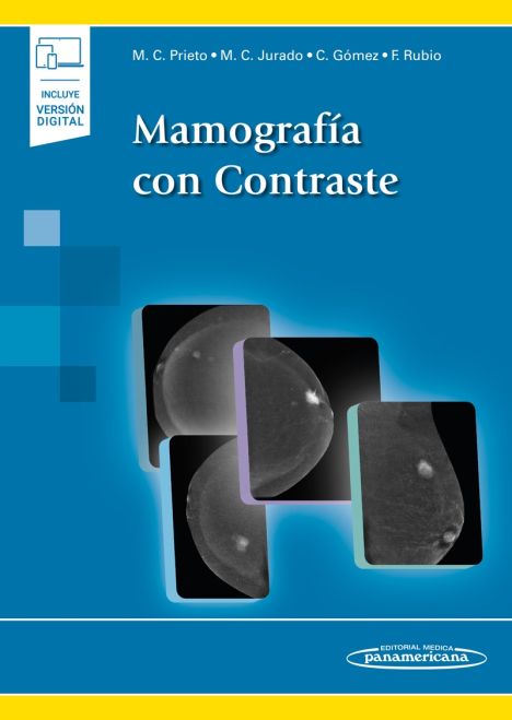 Mamografía con Contraste