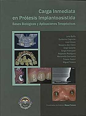 CARGA INMEDIATA EN PROTESIS IMPLANTOASISTIDA 