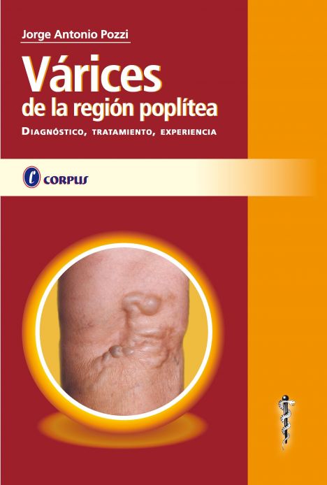 VARICES DE LA REGIÓN POPLÍTEA 