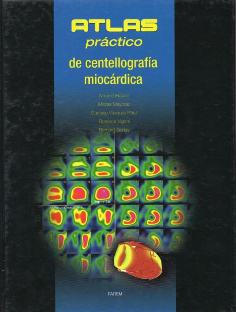 ATLAS PRACTICO DE CENTOLLAGRAFIA MIOCARDICA 