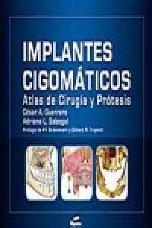 IMPLANTES CIGOMATICOS - ATLAS DE CIRUGIA Y PROTESIS 