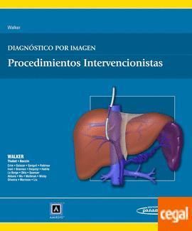 DIAGNOSTICO POR IMAGEN - PROCEDIMIENTOS INTERVENCIONISTAS