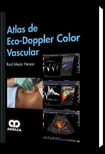 ATLAS DE ECO DOPPLER COLOR VASCULAR 