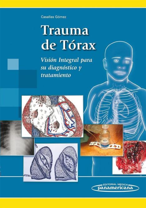 TRAUMA DE TORAX 