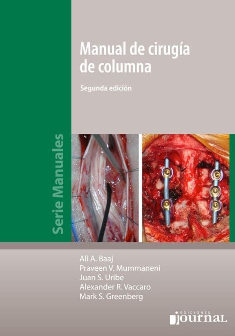 MANUAL DE CIRUGIA DE COLUMNA 2º ED. 