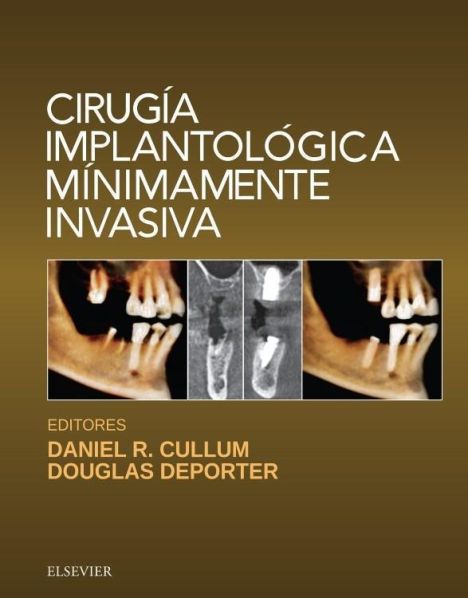 CIRUGIA IMPLANTOLOGICA MINIMAMENTE INVASIVA