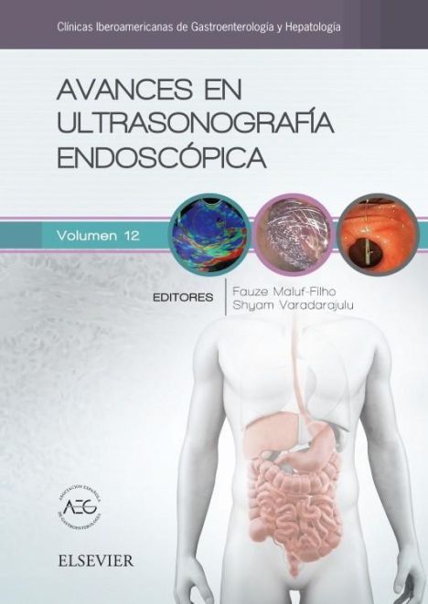 AVANCES EN ULTRASONOGRAFIA ENDOSCOPICA 
