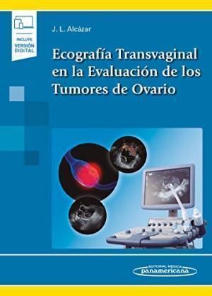 ECOGRAFIA TRANSVAGINAL EN LA EVALUACION DE LOS TUMORES DE OVARIO + EBOOK 