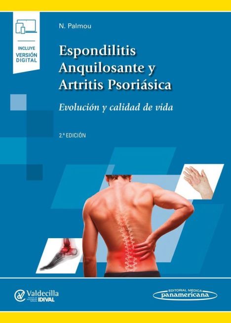 ESPONDILITIS ANQUILOSANTE Y ARTRITIS PSORIASICA 2º ED. + E BOOK 