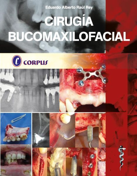 CIRUGIA BUCOMAXILOFACIAL