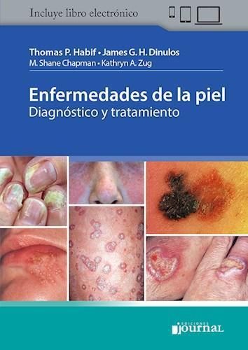 ENFERMEDADES DE LA PIEL - DIAGNOSTICO Y TRATAMIENTO 