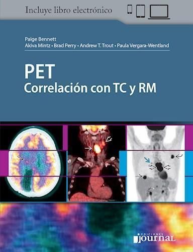 PET CORRELACION CON TC y RM 