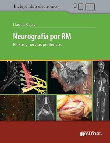 NEUROGRAFIA POR RM - PLEXOS Y NERVIOS PERIFERICOS 