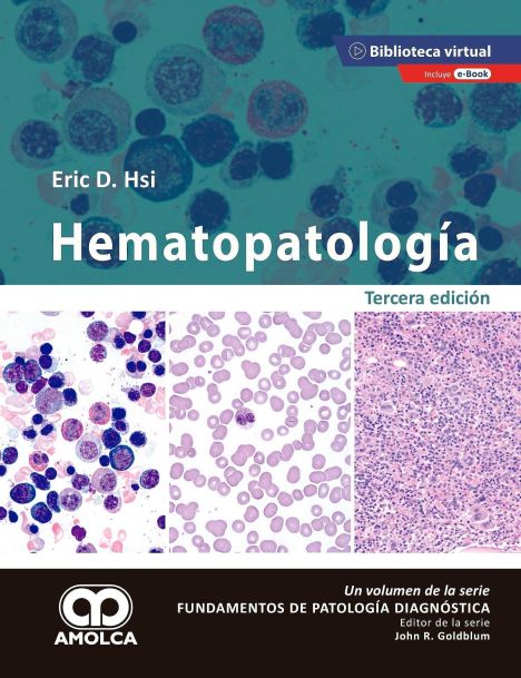 HEMATOPATOLOGIA