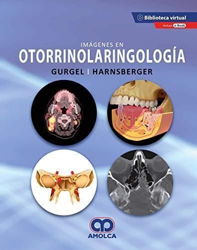 IMAGENES EN OTORRINOLARINGOLOGIA 