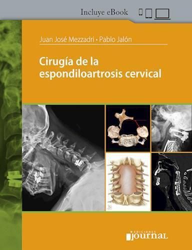 CIRUGIA DE LA ESPONDILOARTROSIS CERVICAL 