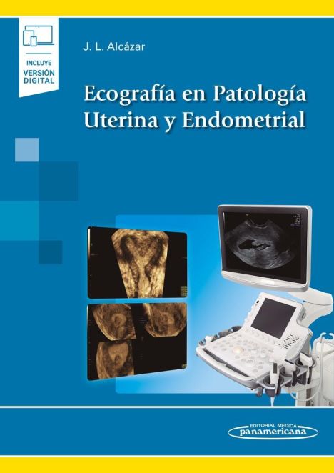 ECOGRAFIA EN PATOLOGIA UTERINA Y ENDOMETRIAL + EBOOK 