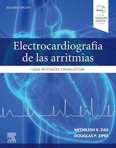 Electrocardiografía de las arritmias Una Revisión Exhaustiva