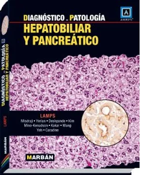 DIAGNOSTICO PATOLOGIA HEPATOBILIAR Y PANCREATICO 