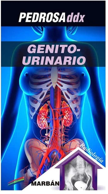 GENITOURINARIO DDX