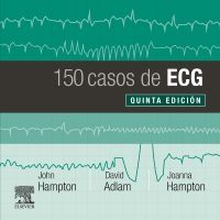 150 CASOS DE ECG 5°ED.