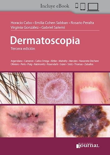 Dermatoscopia Ed.3