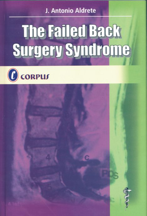 THE FAILED BACK SURGERY SYNDROME