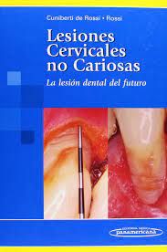 LESIONES CERVICALES NO CARIOSAS 