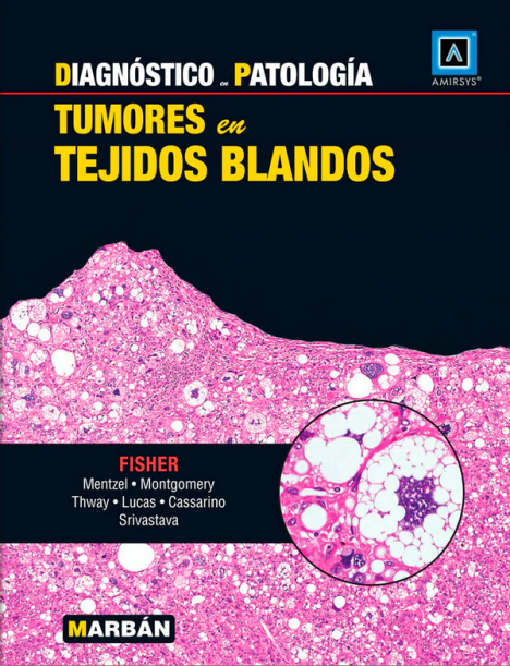 DIAGNOSTICO PATOLOGIA - TUMORES EN TEJIDOS BLANDOS 
