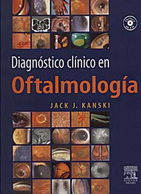 DIAGNOSTICO CLINICO EN OFTALMOLOGIA + CD 