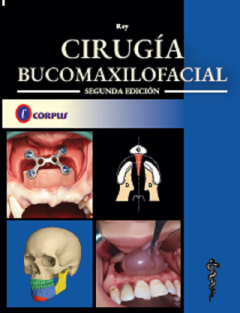 CIRUGÍA BUCOMAXILOFACIAL 2° Edición