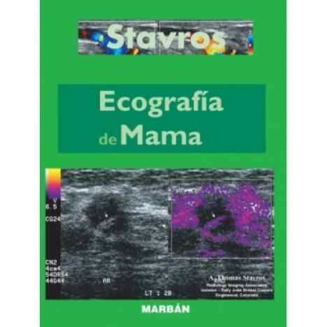 NETO - ECOGRAFIA DE MAMA 