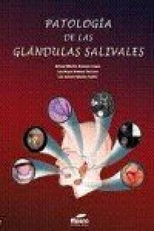 PATOLOGIAS DE LAS GLANDULAS SALIVALES 