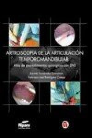 ARTROSCOPIA DE LA ARTICULACION TEMPOROMANDIBULAR - ATLAS PROC. QUIRURGICOS 