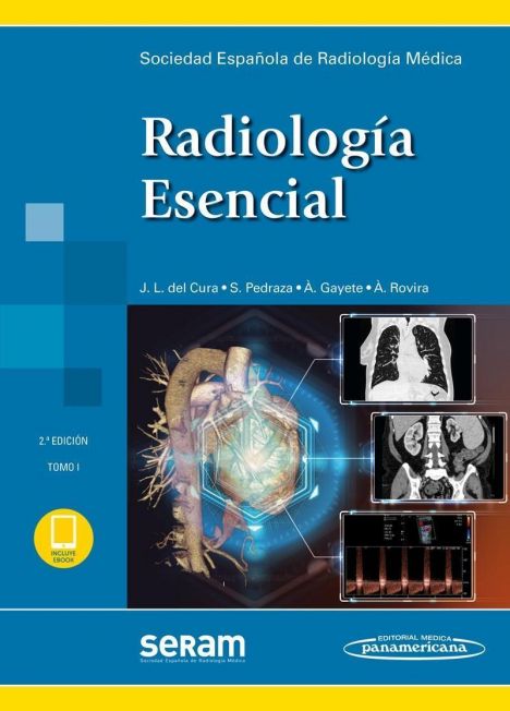 RADIOLOGIA ESENCIAL 2 VOLS. 2º ED. + EBOOK 