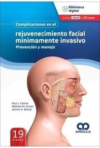 Complicaciones en el Rejuvenecimiento Facial Mínimamente Invasivo. Prevención y Manejo