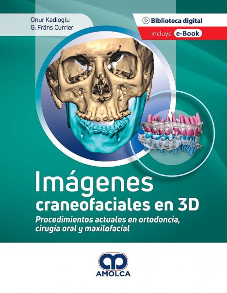Imágenes Craneofaciales en 3D. Procedimientos Actuales en Ortodoncia, Cirugí­a Oral y Maxilofacial