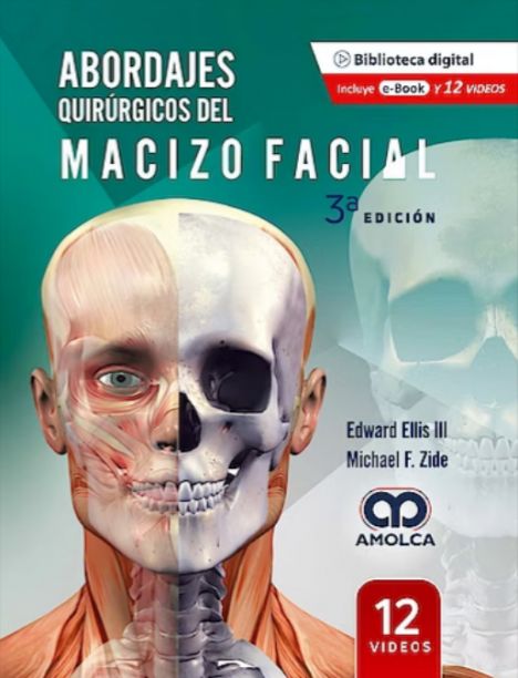 Abordajes quirúrgicos del macizo facial 3º ed.