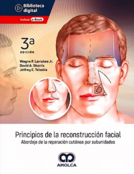 Principios de la reconstrucción facial