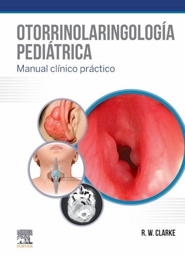 Otorrinolaringología pediátrica. Manual Clínico Práctico.