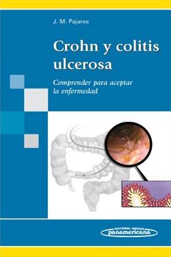 Crohn y Colitis Ulcerosa