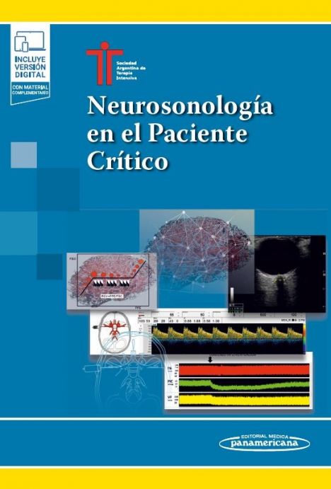 Neurosonología en el Paciente Crítico + EBook