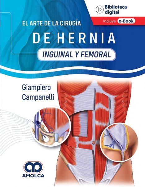 El arte de la Cirugía de la Hernia - Inguinal y Femoral