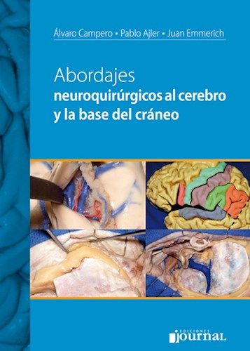 ABORDAJES NEUROQUIRURGICOS AL CEREBRO Y LA BASE DEL CRANEO 