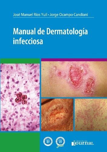 MANUAL DE DERMATOLOGIA INFECCIOSA 