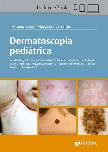 Dermatoscopía Pediátrica