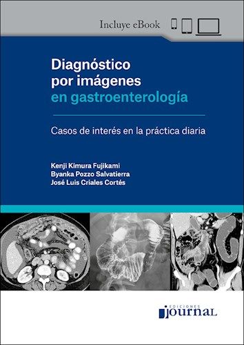 Diagnóstico por imágenes en gastroenterología. Casos de interés en la práctica diaria + EBook