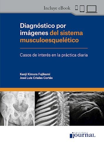 Diagnóstico por imágenes del Sistema Musculoesquelético