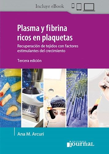 Plasma y fibrina ricos en plaquetas 3º Ed