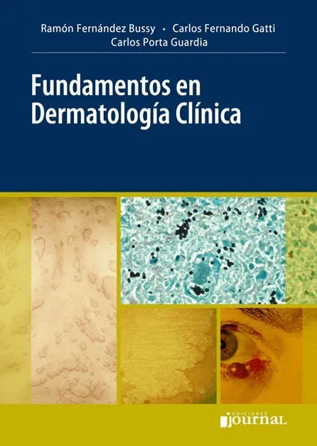 Fundamentos de Dermatología Clínica
